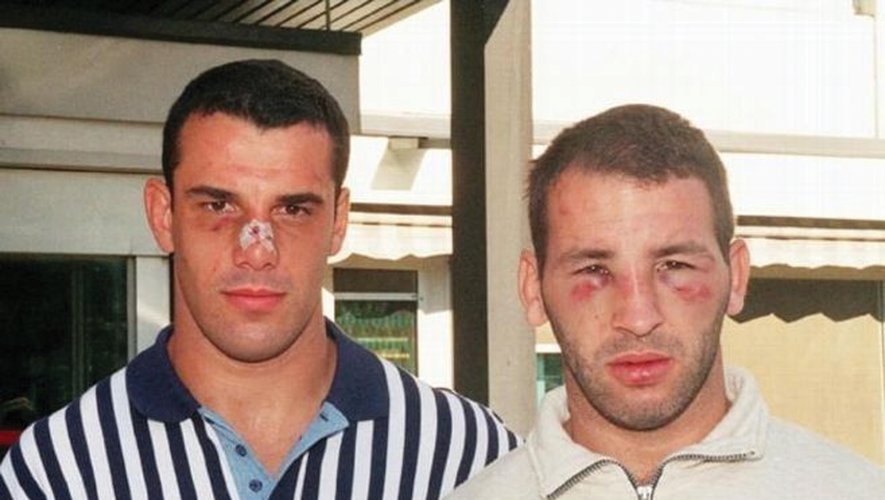 Les visages tuméfiés de Cristophe Lamaison et Philippe Carbonneau après la « bataille du Toulzac »