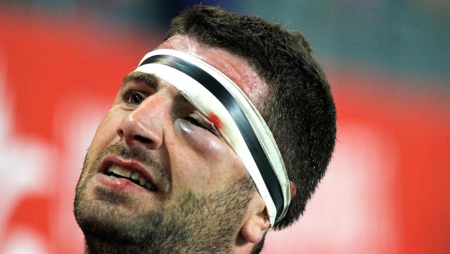 La blessure à l'oeil de Jonathan Best - Toulon Grenoble - 31 août 2013