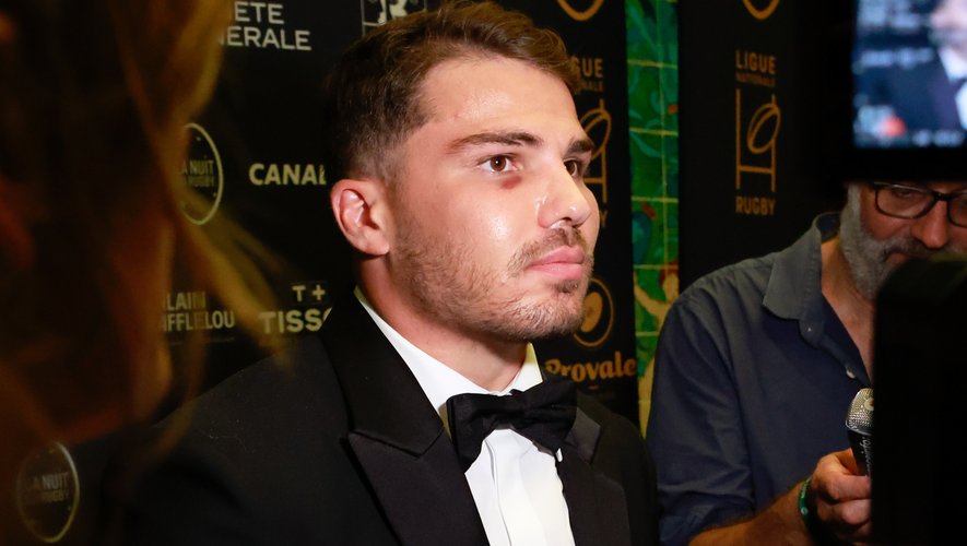 XV de France – Antoine Dupont dévoile les plaques qui lui avaient été posées après sa blessure à la pommette - rugbyrama.fr